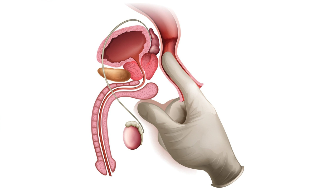 Massaggio alla prostata
