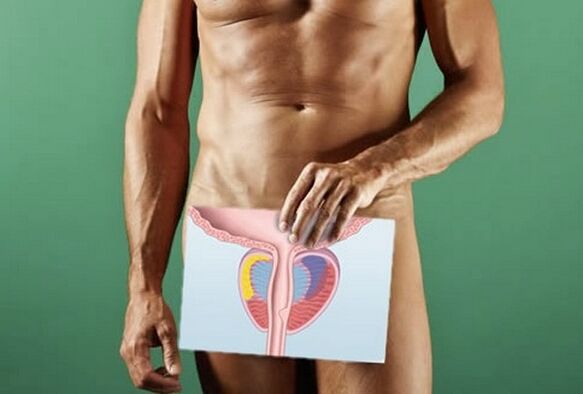 Un uomo affetto da prostatite